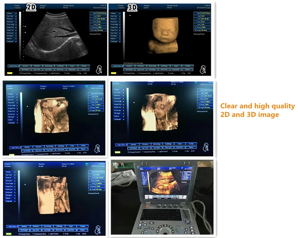 Профессиональный портативный 3D цветной дисплей черно-белый ультразвуковой