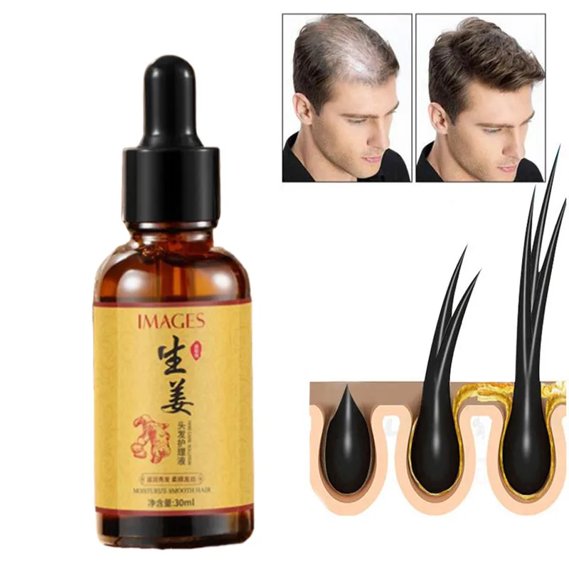 

30ML Ginger Hair Growth Essential Oil Products Anti Hair Loss Serum Fast Growing Nourish Soften Scalp Repair Damaged Hair Care