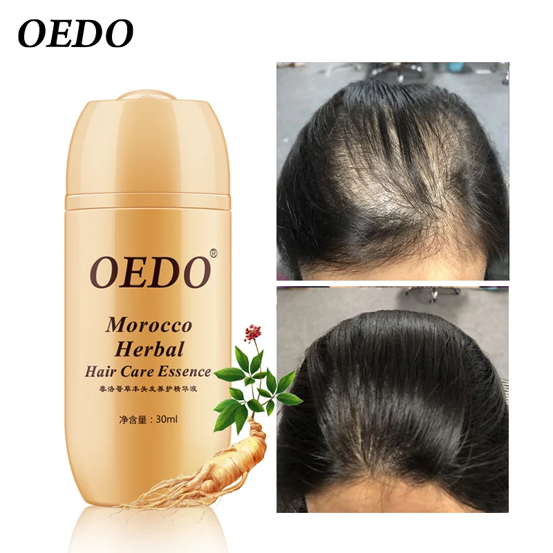 30ml Morocco Ginseng Hair Growth Essence Prevent Hair Loss Products Repair Damaged Fizzy Dry Thin Hair Scalp Baldness Treatment