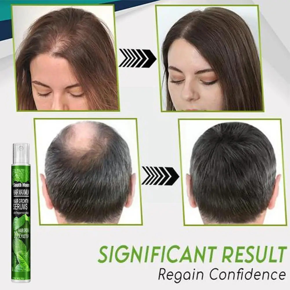 

New Hair Growth Spray Serum Anti Hair Loss Products Damaged Repair Prevent Fast Hair Care Dry Thinning Grow G5u7