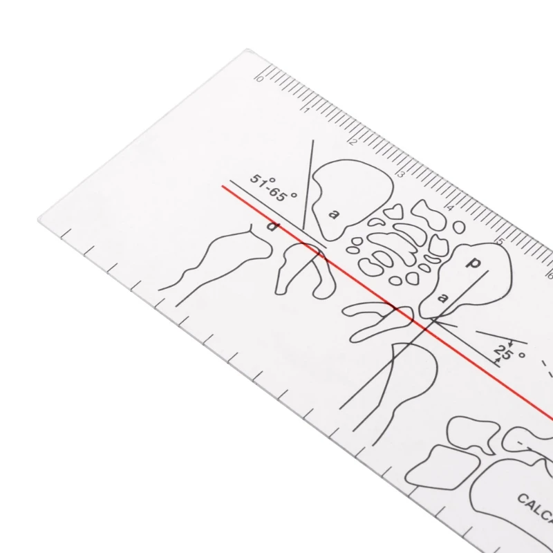 

Профессиональная портативная ортопедическая медицинская измерительная угловая линейка Прямая поставка