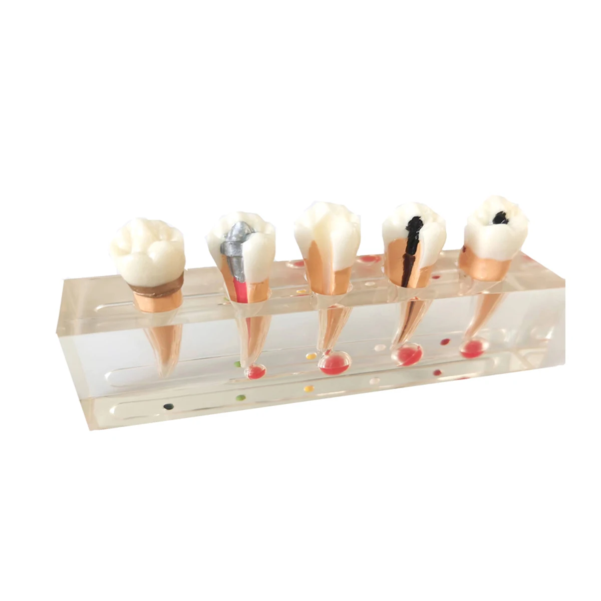 

Dental Teaching Model 5-Stage Simulation Endodontic Treatment Model Dental Study Teach Teeth Model
