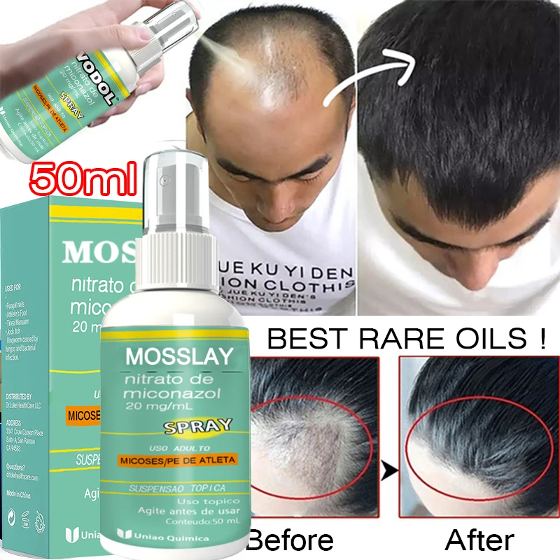 

Ginger Hair Growth Oil Mist To Help Promote Hair Growth and Reduce Hair Loss