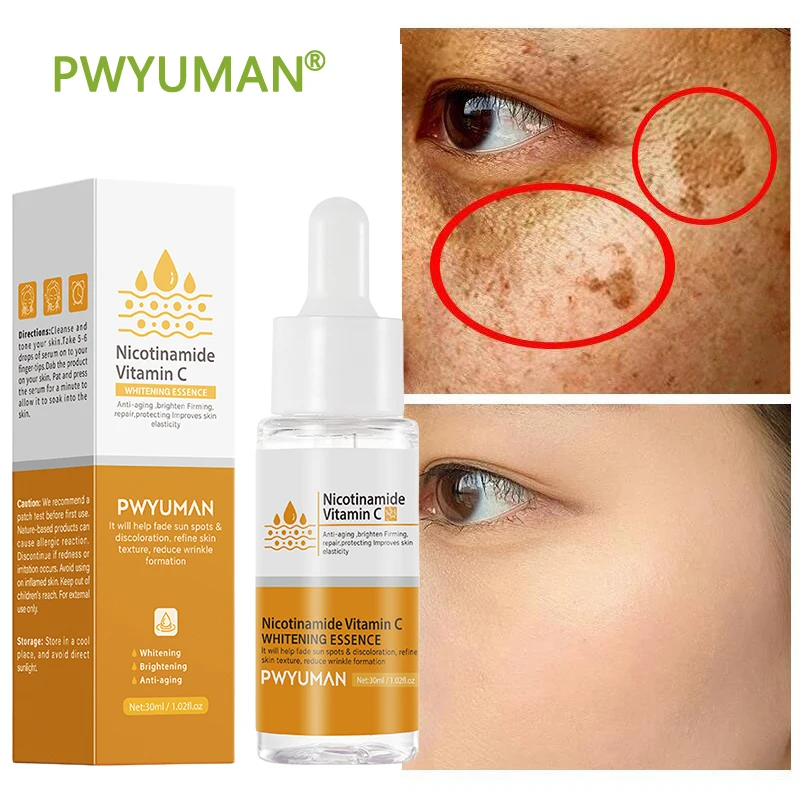 Сыворотка для лица с витамином C Niacinamide отбеливающий крем удаления веснушек
