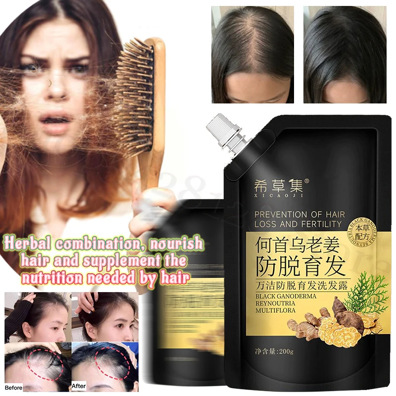 

Polygonum Multiflorum Ginger Anti-hair Loss Anti-dandruff Oil Control Shampoo Nourishing Repair Strong Hair Root Mild Shampoo