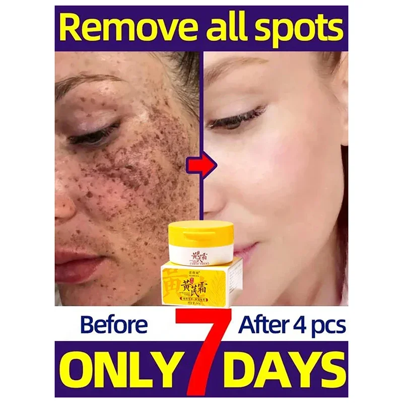 Huangqi морозное отбеливание увлажняющее средство для удаления акне осветление