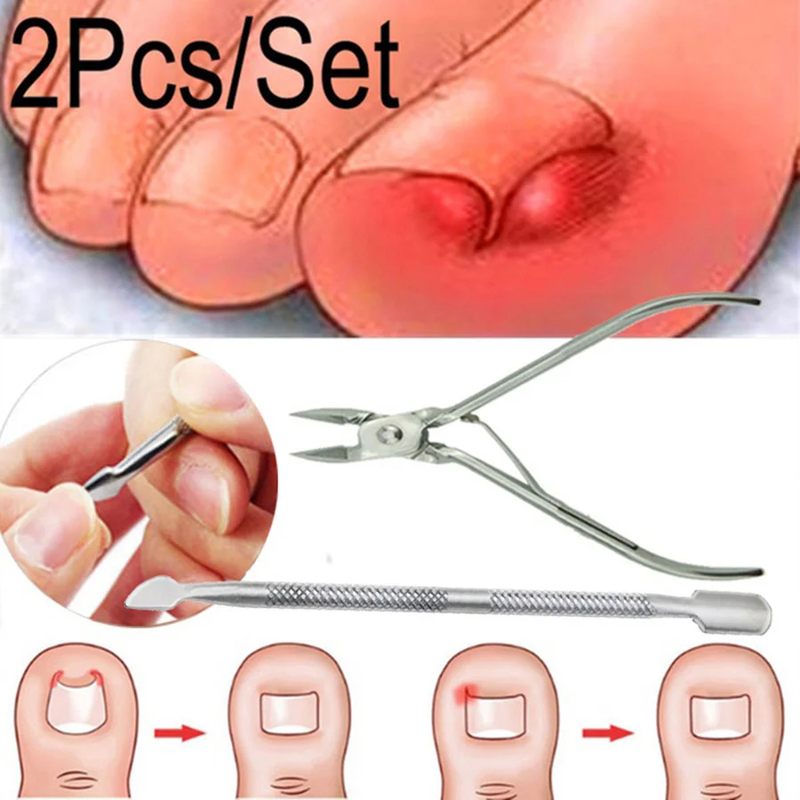 

2Pcs/Set Ingrown Toe Nail Correction Nippers Clipper Cutters Dead Skin Dirt Remover + Paronychia Podiatry Pedicure Care Tool