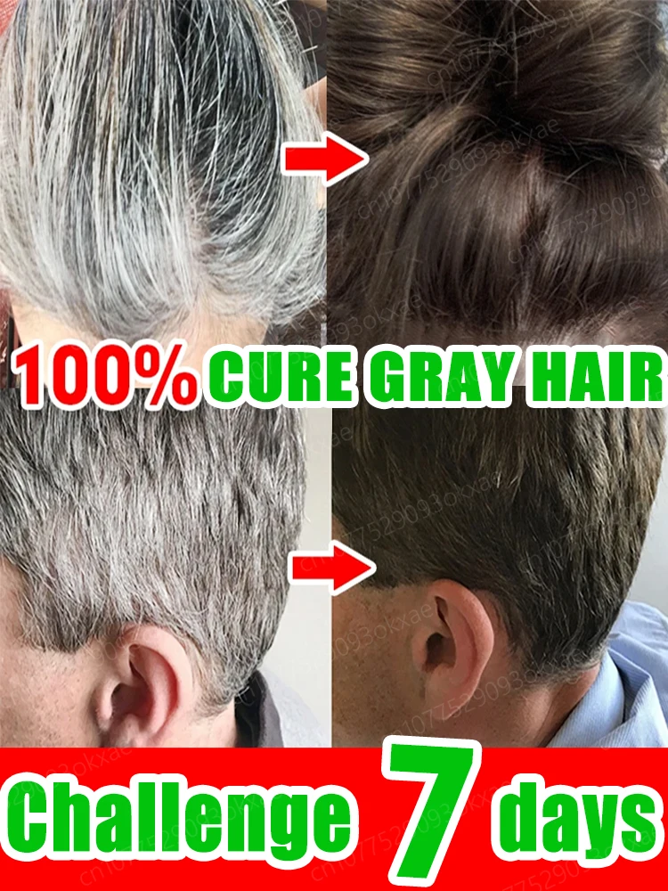 

Anti Gray Hair Serum White Darkening Natural Hair Color