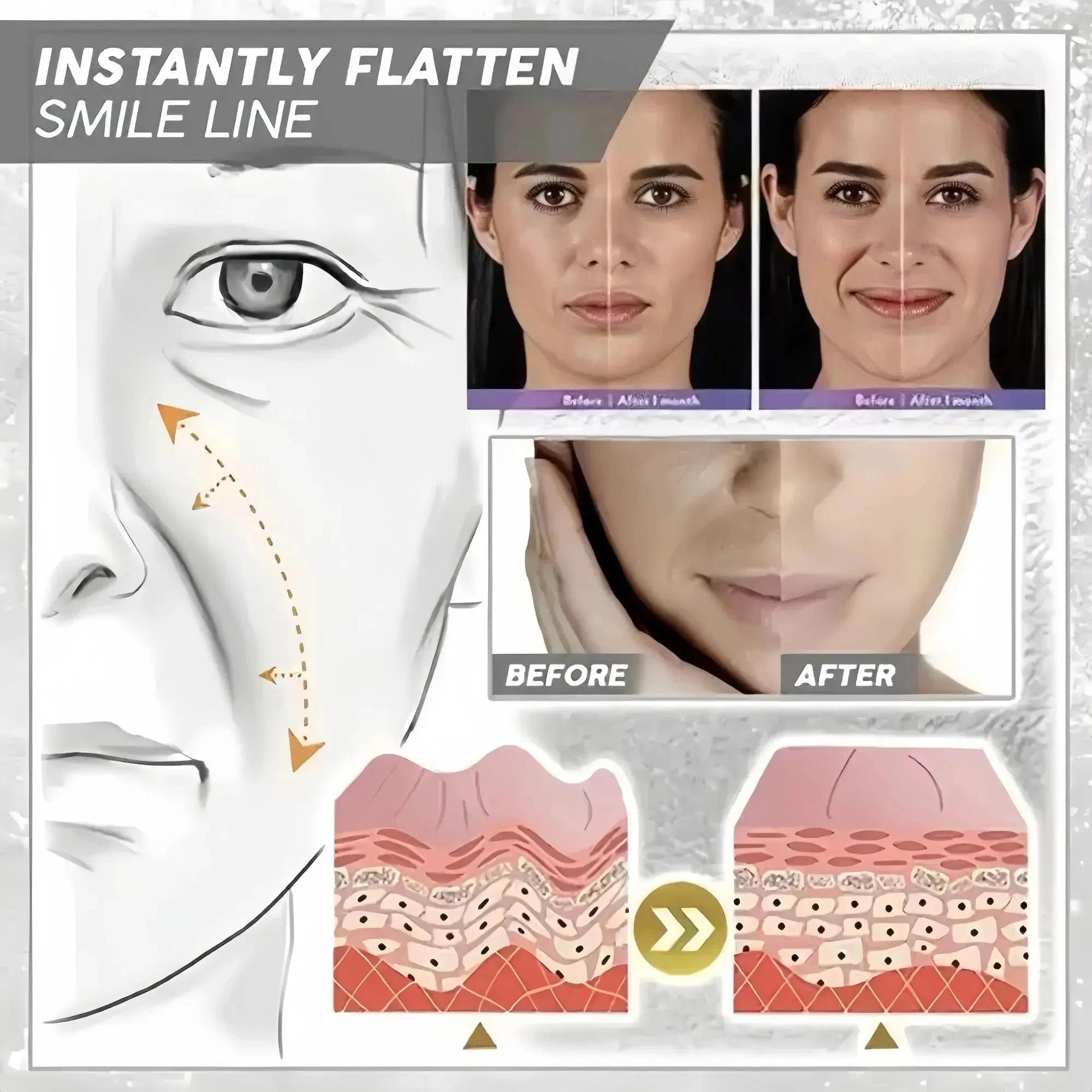 Крем для удаления морщин с ретинолом мгновенный укрепляющий лифтинг против