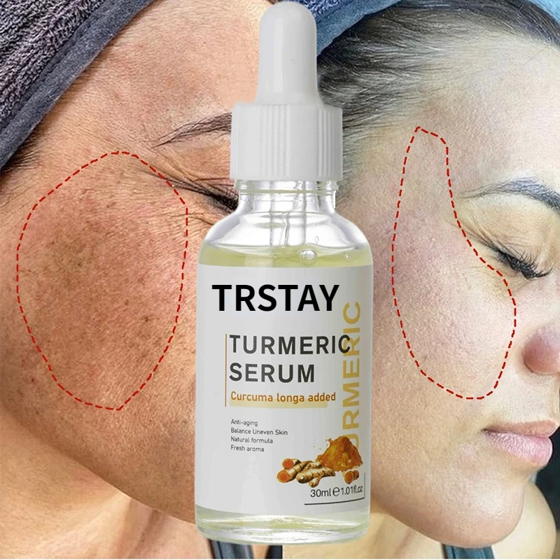 

Turmeric Face Serum Whitening Dark Spot Remover Acne Scar Bright Skin Corrector Facial Essence Improve Roughness Skin Care