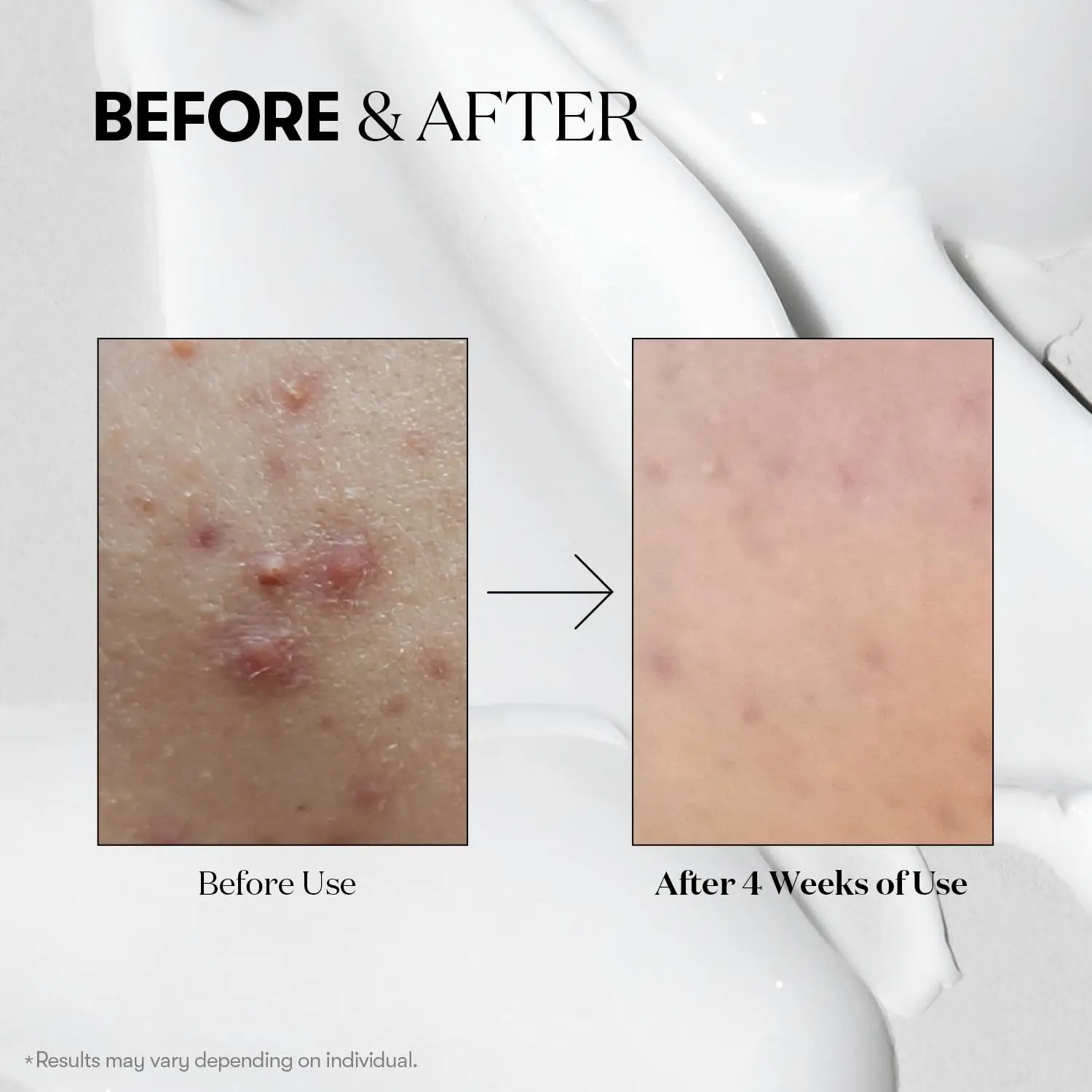 VT COSMETICS CICA Reedle Shot 100 ежедневный ночной экзосом сыворотка для микронидлинга