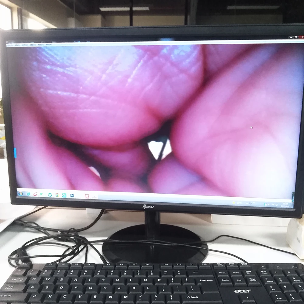 Цифровой эндоскоп Wi-Fi беспроводная винтовая камера USB-видео omnivision ov6948