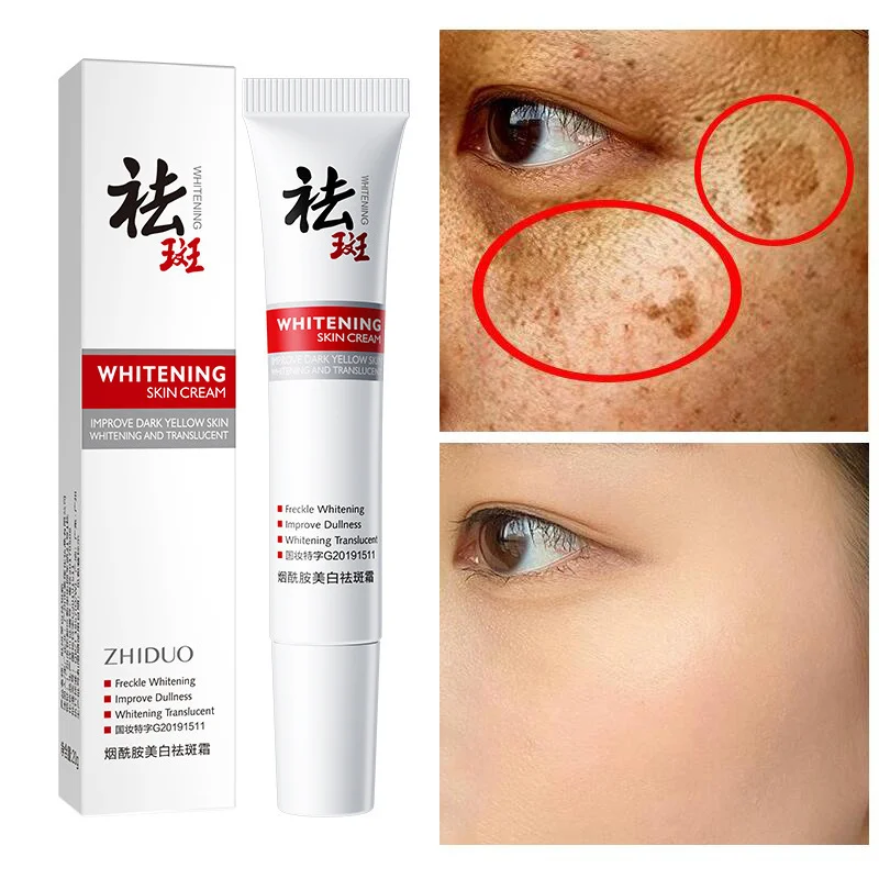 Arbutin Freckles Removal Whitening Cream Nicotinamide Light Spot Break Down Pigments Remove Melasma Dark Spot Korean Cosmetics