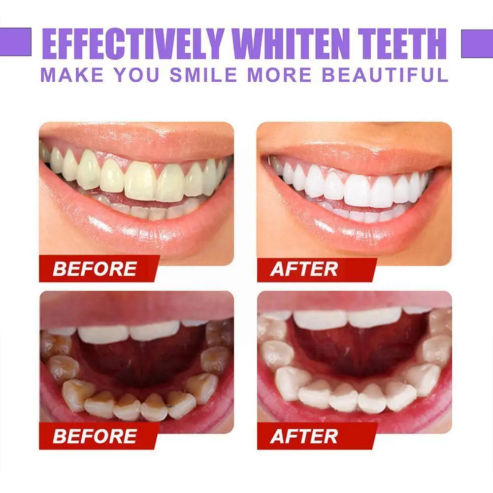 

Fruit Toothpaste Clean Tooth Whitening Care Toothpaste Fruity Cleaning Anti-moth Hygiene Care 30ml Toothpaste Fragrance R8W5