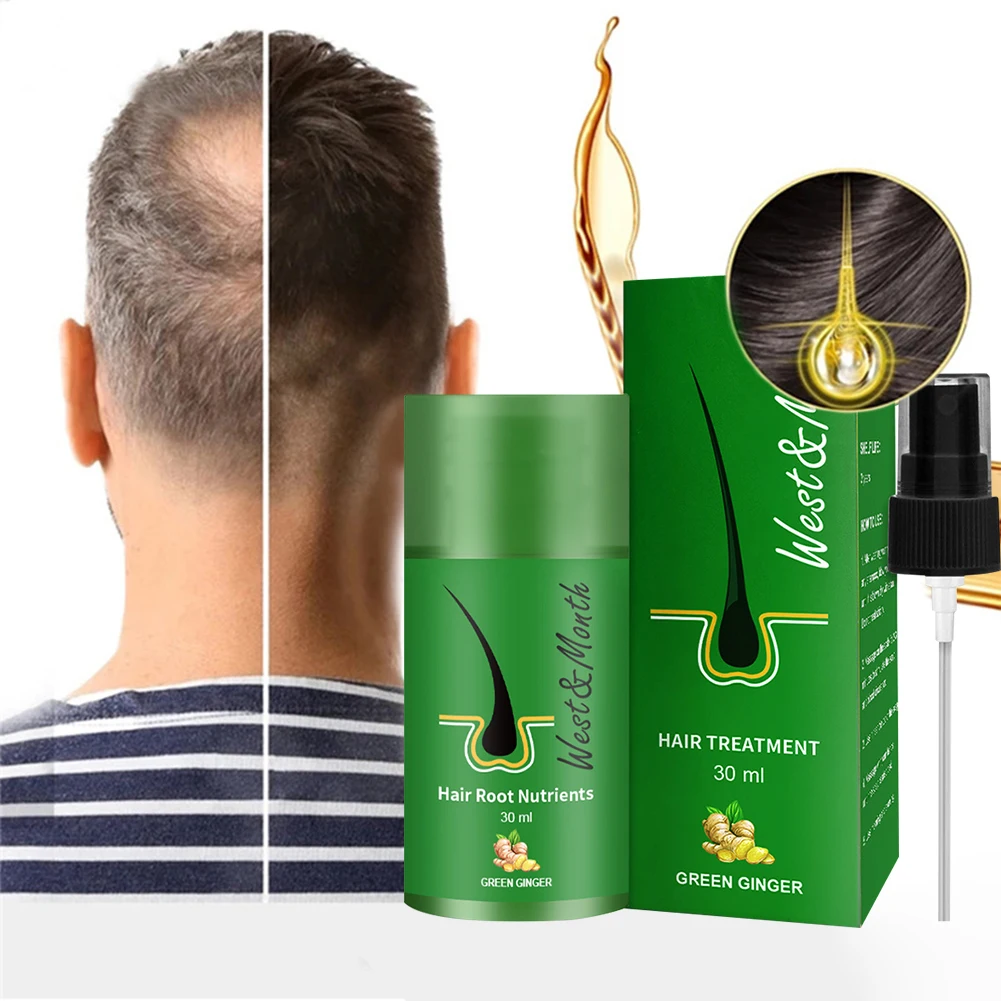

30ml Hair lotion Hair Growth Serum Essence Oil Hair Loss Treatment Growth Hair for Men Women Thailand Anti Hair Loss Spray