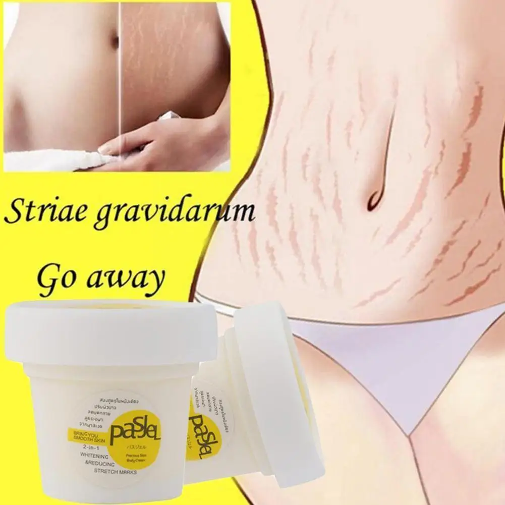 

Maternity Scars Acne Cream Pregnancy Stretch Marks Body New Cream Cream Increase Removal Stretch Remove Old Elasticity Mark O4Q0