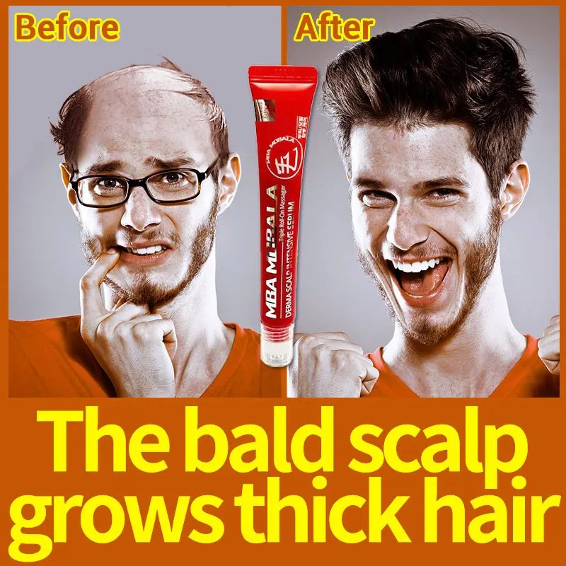 

Сыворотка для роста волос для мужчин и женщин, Мужская Сыворотка для роста волос, Мужская t-обработанная продукция для волос с быстрой идентификацией, защита от выпадения волос