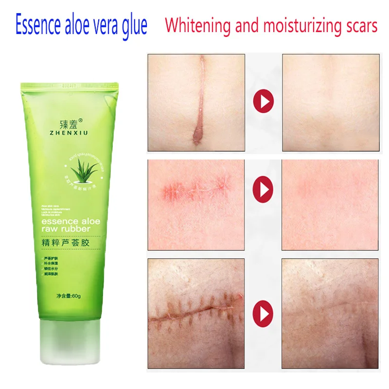 

99% Aloe Soothing Gel Aloe Vera Gel Anti Wrinkle Acne Scar Treatment Cream Sunscreen Aloe Gel Sunburn Repair