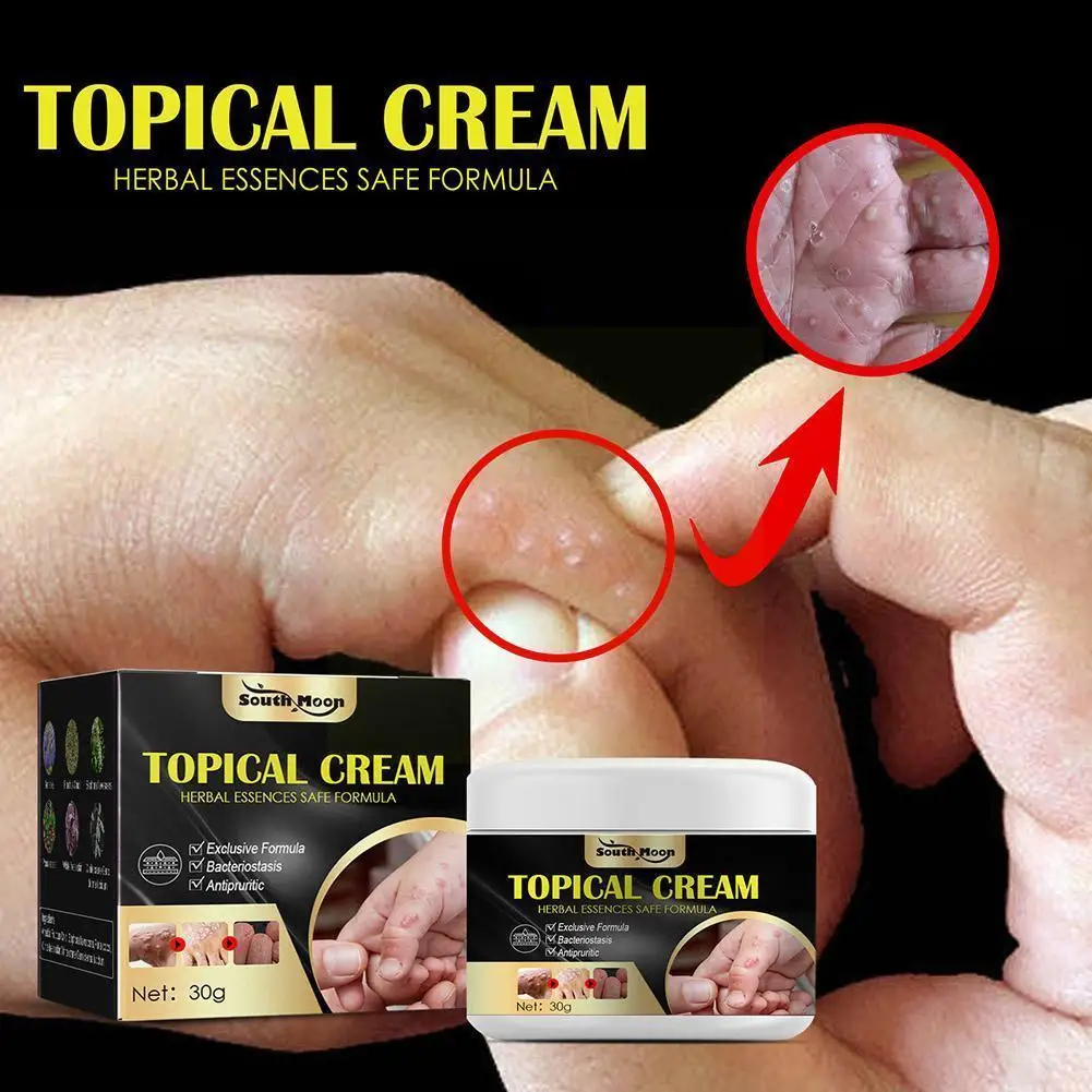 

Body Cream Skin Care Psoriasis Dermatitis Itching Repair Cream Body Psoriasis Eczema Dropshipping Treatment Antibacterial Y6k7