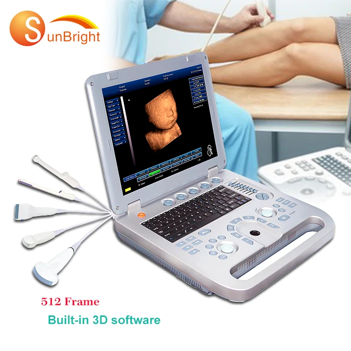 

Portable diagnostic 3D Sun-800d ultrasound price