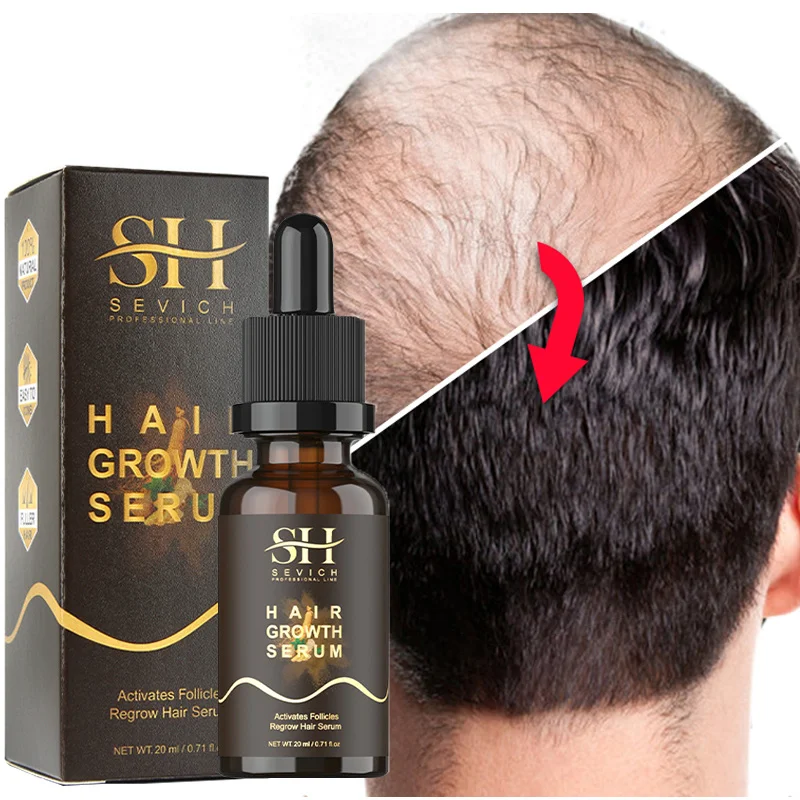 Fast Hair Growth Oil Serum Prevent Hair Loss Products Treatment Scalp Ginger Essence Growing Anti Hair Loss Care Men Women 20ml