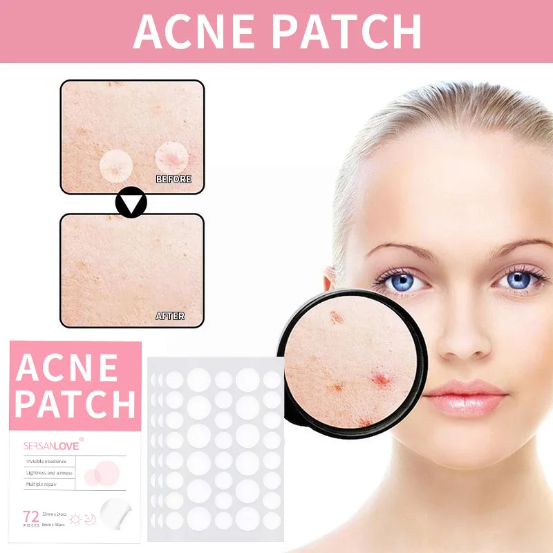 

72 Pcs Acne Pimple Patch Invisible Ibreathable Acne Pimple Stickers Waterproof Skin Care Pimple Remover Tools Acne Treatment