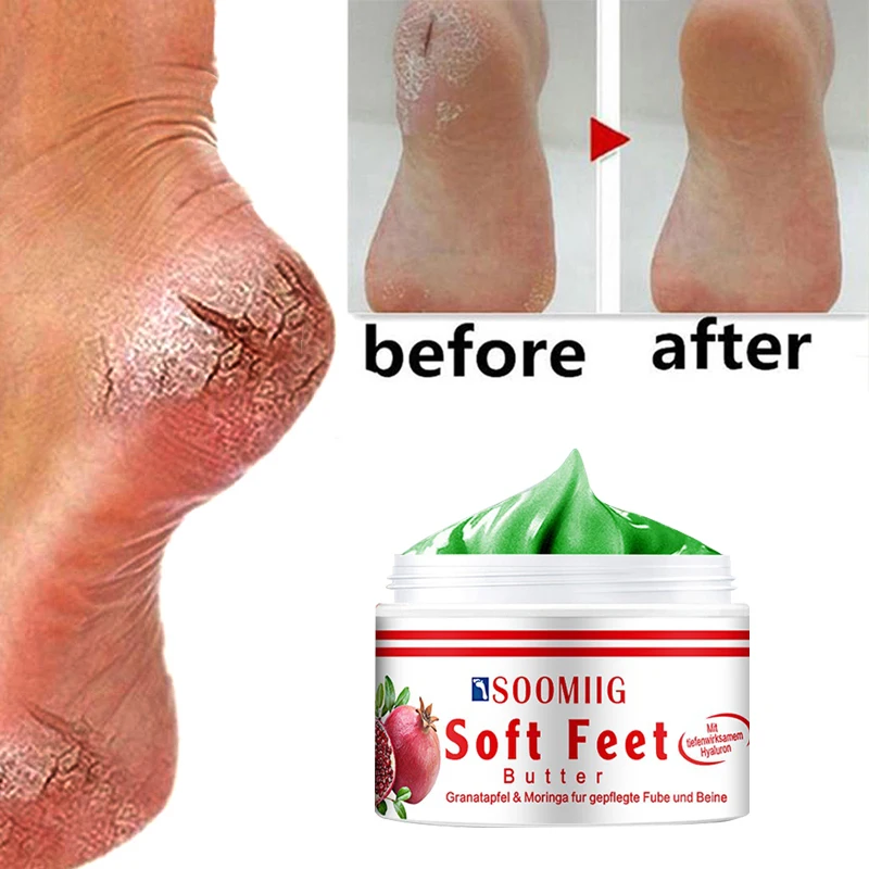 

Chinese traditional chapped Repairing Cream Anti dryness repairing heel cracking repairing removing dead skin hand and foot care