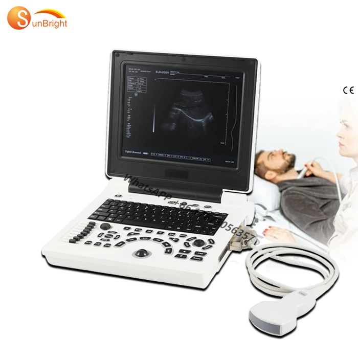 

Portable machine ultrasound equipment ultrasonography machine laptop SUN-806H