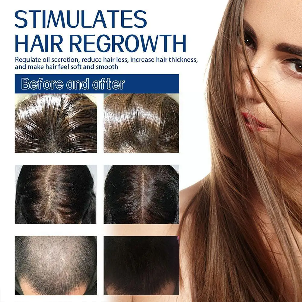 

1 шт. шампунь для роста волос натуральный скраб для волос шампунь для ухода за волосами скраб для кожи головы отшелушивающее средство Q3W0