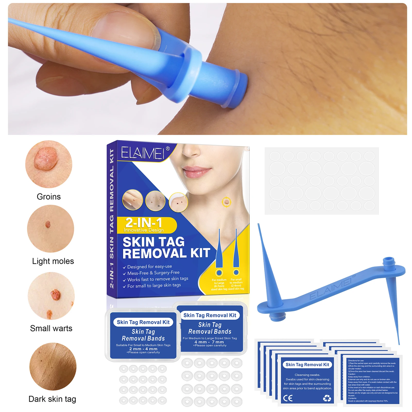 

1 Set Home Use Skin Tag Removal Kit Mole Wart Remover Equipment Micro Skin Tag Treatment Tool With Cleansing Swabs Easy To Clean