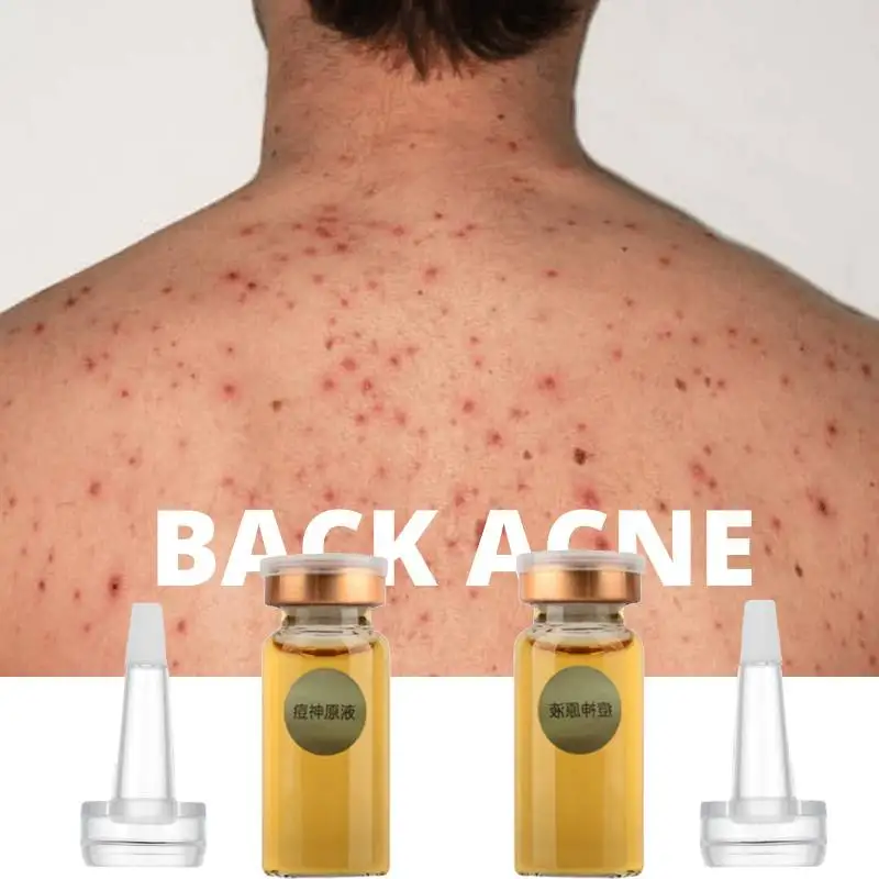 

Body Acne Spray Back Acne Treatment 2% Salicylic Acid Tea Tree Serum Clear Spots Scars Marks Stretch Blemish Pimples Body Oil