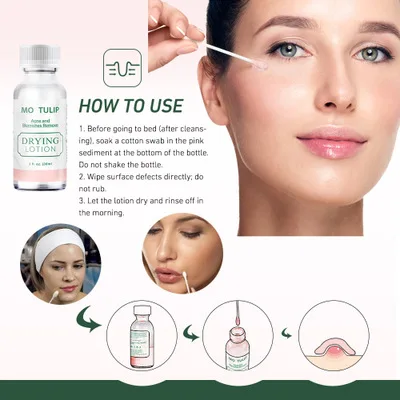 Эффективное лечение акне 30 мл сушильный лосьон Mario Badescu сыворотка против Удаление