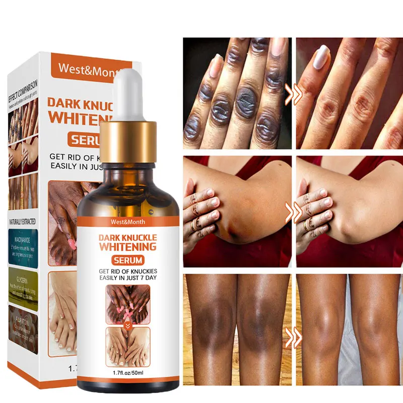 

75g Joint Deblackening Beauty Serum Lighten Melanin Knee Ankle Corner Brighten Skin Tone Armpit Whitening Rejuvenation Bleaching