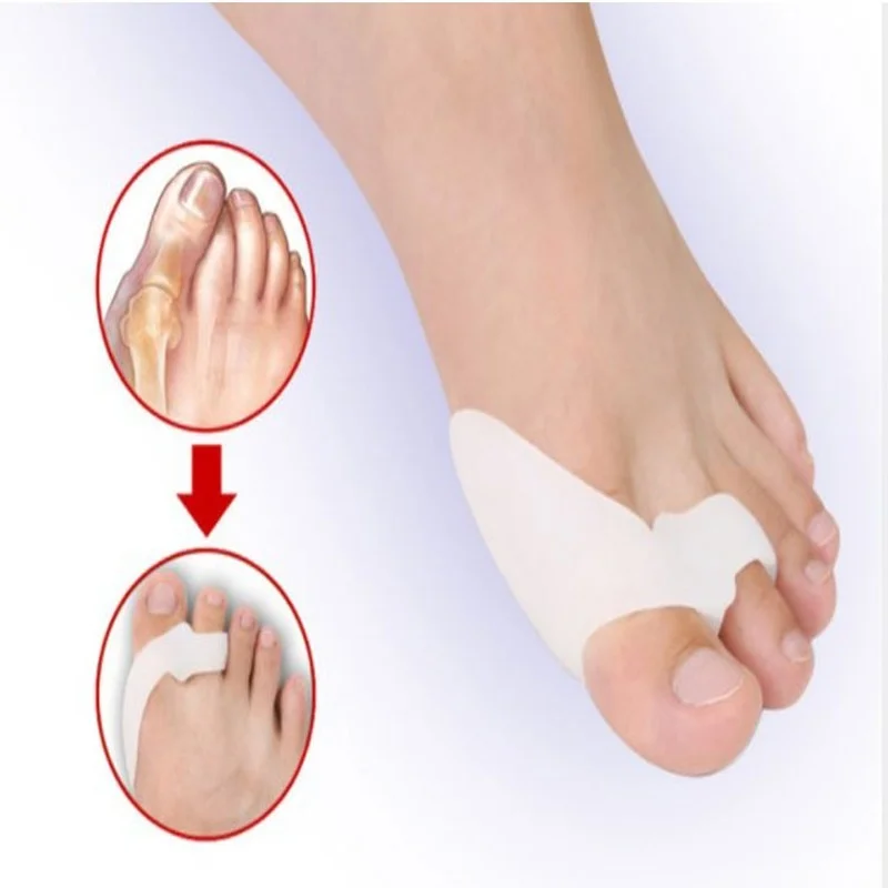

Hallux Valgus Big Toe Corrector Bone Orthotics Braces Bunion Orthopedic Thumb