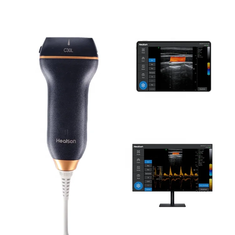 

Healson C30 Linear portable color Doppler USB smartphone ultrasound machine