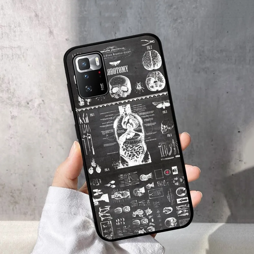 Радиологический каркас человеческих органов телефон планшетофон X 5 A 6 7 8 Pro T9 9S 10 11