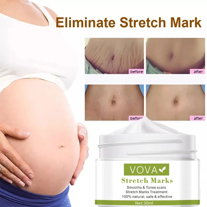 

Pregnancy Repair Cream Stretch Mark Removal Removal Acne Scar Stretch Marks Cream Fat Striae Gravidarum Treatment Body Creams