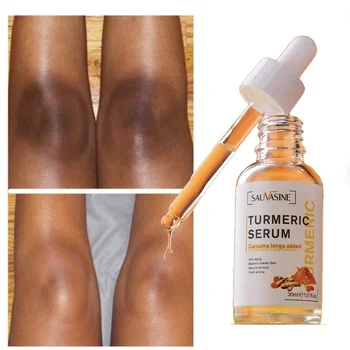 Turmeric elbow and knee whitening serum for brightening dark spots and uneven skin tone