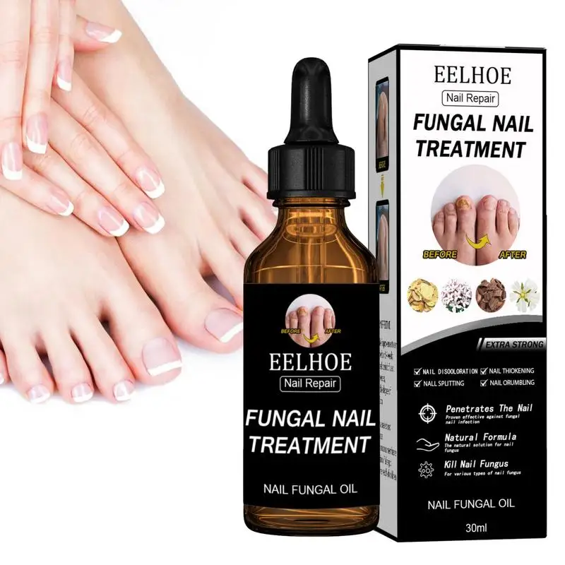

Nail Renewal Solution Natural Powerful Anti-Nail Treat Effective Nail Solution For Discolored And Damaged Nails Brittle Nails
