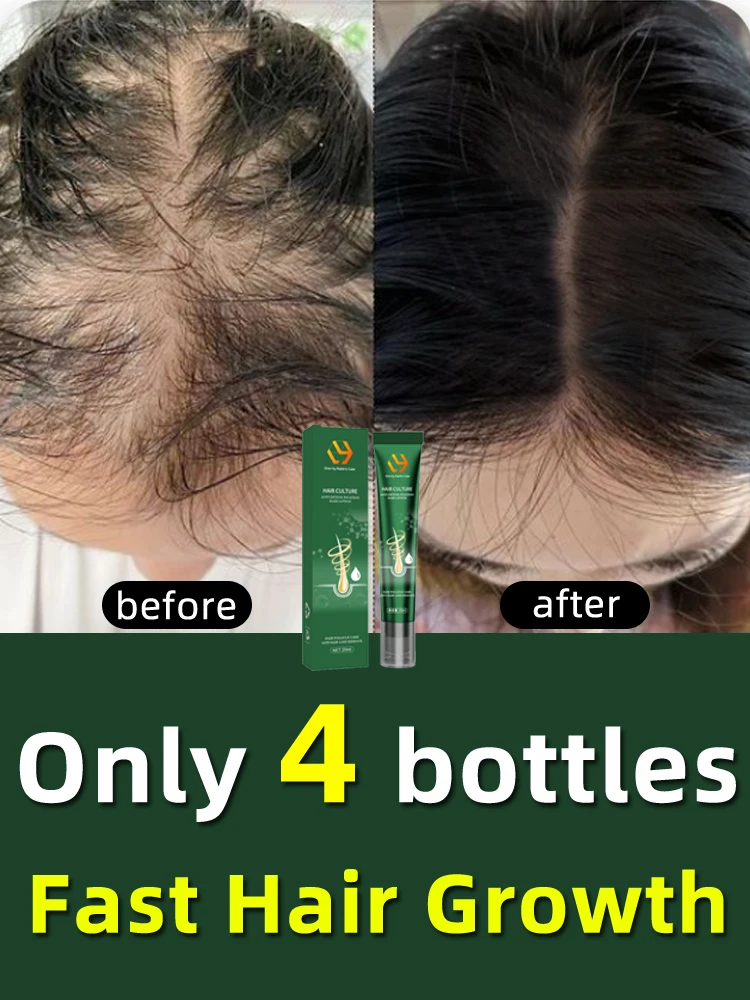

Hair Regrowth Serum Hair Loss Biotin Fast Hair Growth Damaged Hair Repair Hair Thinning Treatment