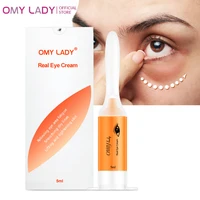 eye cream instant remove eyebags firming eye anti puffiness dark circles under eye anti wrinkle anti age eye care