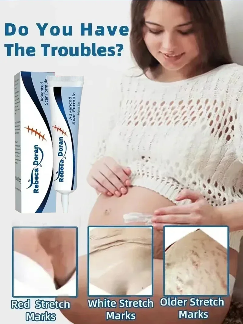 Крем для беременных повышает эластичность нежный уход за кожей после