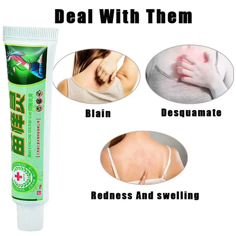 

Psoriasis Antibacterial Cream Dermatitis Eczematoid Ointment China's Secret Recipe （With Retail Box）