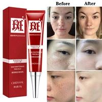 effective whitening freckle cream fade dark spots melanin even skin tone removal melasma skin whitening moisturizing care cream