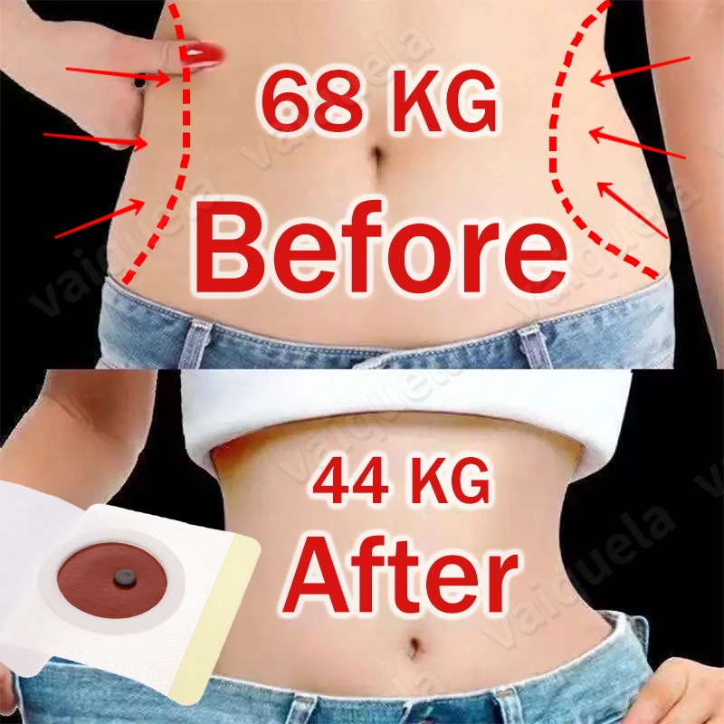 

150/300pcs Navel Slim Stickers Slimming Patch Weight Loss Burning Fat Efficacy Chinese Herbal Medical Plaster Product New