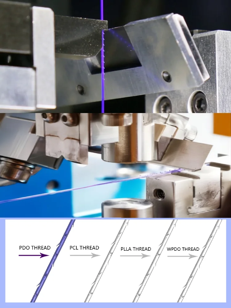 

Лифтинг для лифтинга лица UVERLA V Line, Корейская нить PDO/PCL, шов 4D Cog 21 г 60 мм Cog 4d L PCL W 400 мм, большая V-образная тугая нить в виде рыбьей кости