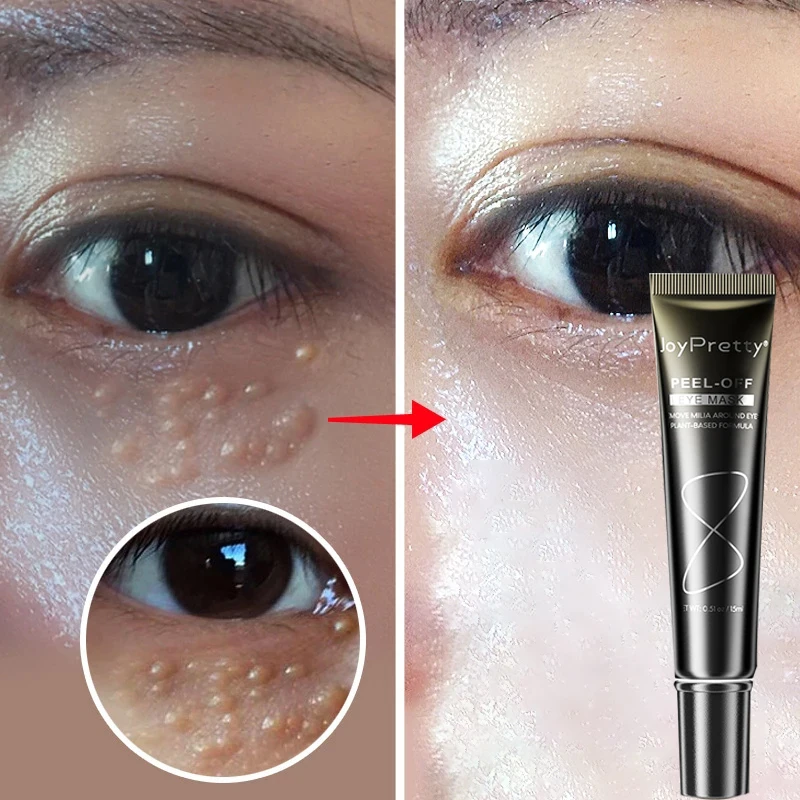 

Fat Granules Eye Cream Anti Dark Circle Eye Bags Remove Serum Vitamin E Wrinkle Lifting Cream Patches Face Skin Care Products