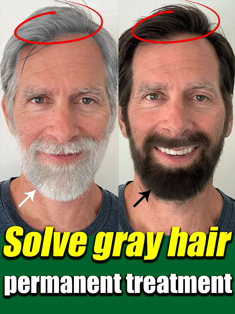 Suero Natural Anti gris para el cabello reparación de blanco y oscurecimiento remedio nutritivo cuidado del