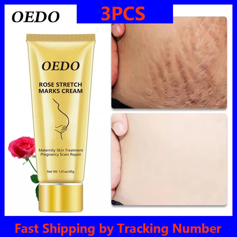 

3PC Rose Removes Stretch Mark Cream To Remove Postpartum Obesity Pregnant Women Repair Anti-Aging Anti-Winkles Firming Body Care