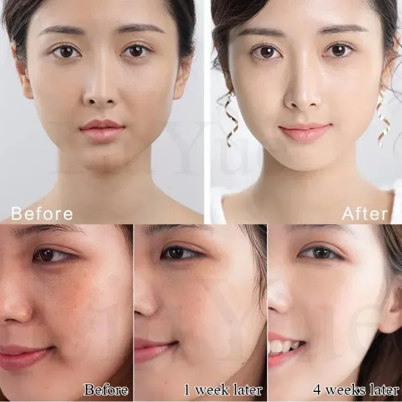 Отбеливающая Сыворотка с гиалуроновой кислотой глубокое увлажнение уменьшение